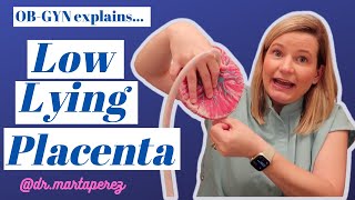 Low Lying Placenta Explained: Risks, Sex, Exercise, C-section vs Vaginal birth, Marginal previa