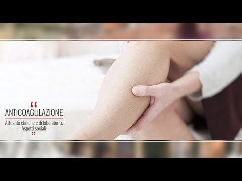 Video: Sindrome Posttromboflebite: Cause, Sintomi E Trattamento