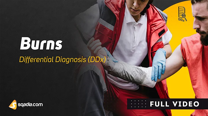 Burns Symptoms | Differential Diagnosis (DDx) | Emergency Medicine Education