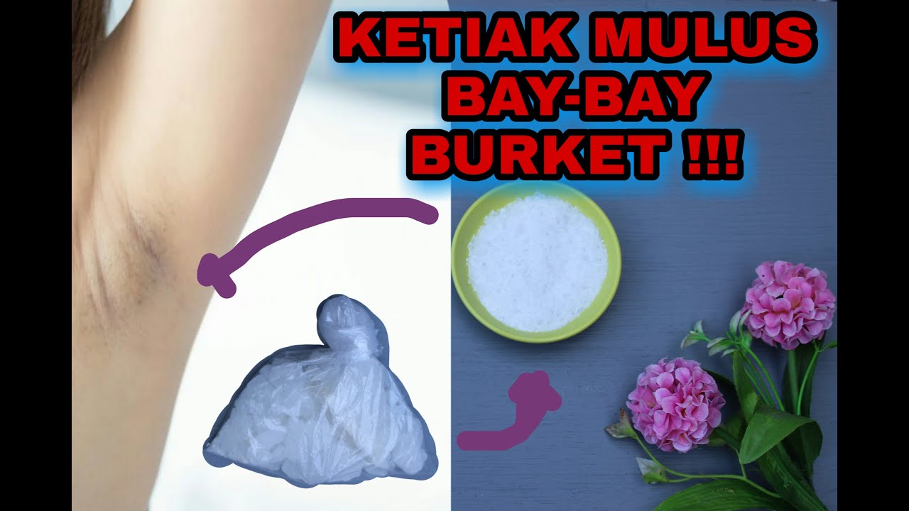 Mengurangi Burket Cara Mengurangi Burket Cara