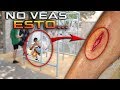 INTENTAMOS ENTRENAR y ACABAMOS en el HOSPITAL🤕 Vlog PARKOUR