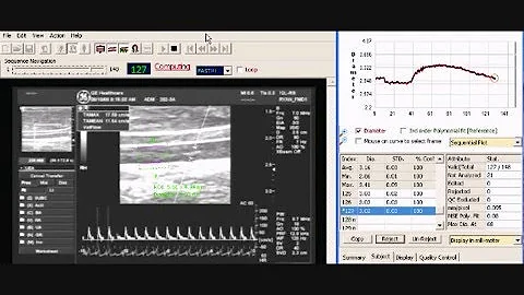 Flow-mediated dilation