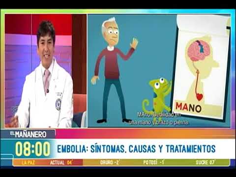 Paralisis o de sintomas embolia