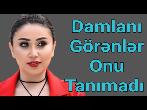 Damlanın Bu Görünüşü Hələ Çox Danışılacaq - FOTOLAR