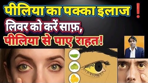💛 Jaundice Ka 100% Natural Ilaj ❗ Causes, Symptoms & Home Remedies |