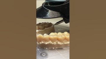 Aligner-Trimming mit Trimlign powered by EMO Systems!