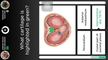 How to Hack QuizUp-Easy JailbreakTutorial