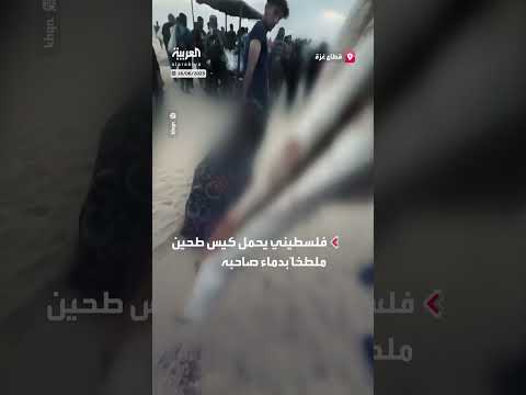 فلسطيني والدماء والطحين في غزة: مشهد من توزيع المساعدات