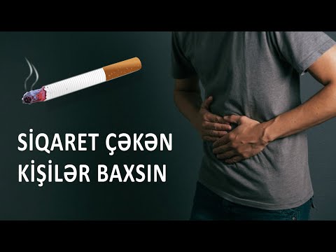 Video: Xərçəng Necə çəkilir