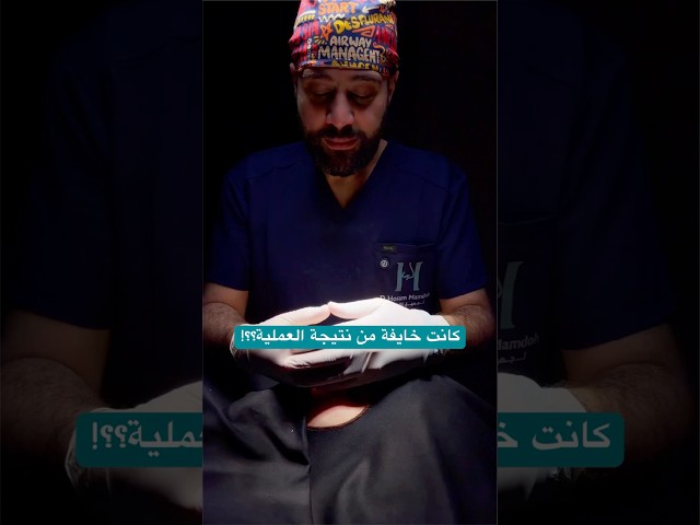 كانت مترددة وخايفة من نتيجة عملية تجميل الانف ؟؟! النتيجة 👆#جوهرجى_الانف #دحسام_ممدوح