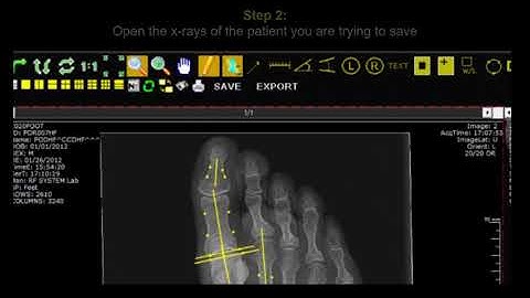 How to Save DICOM images 💿💽🖥️ #howto