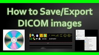 How to Save DICOM images 💿💽🖥️ #howto screenshot 5