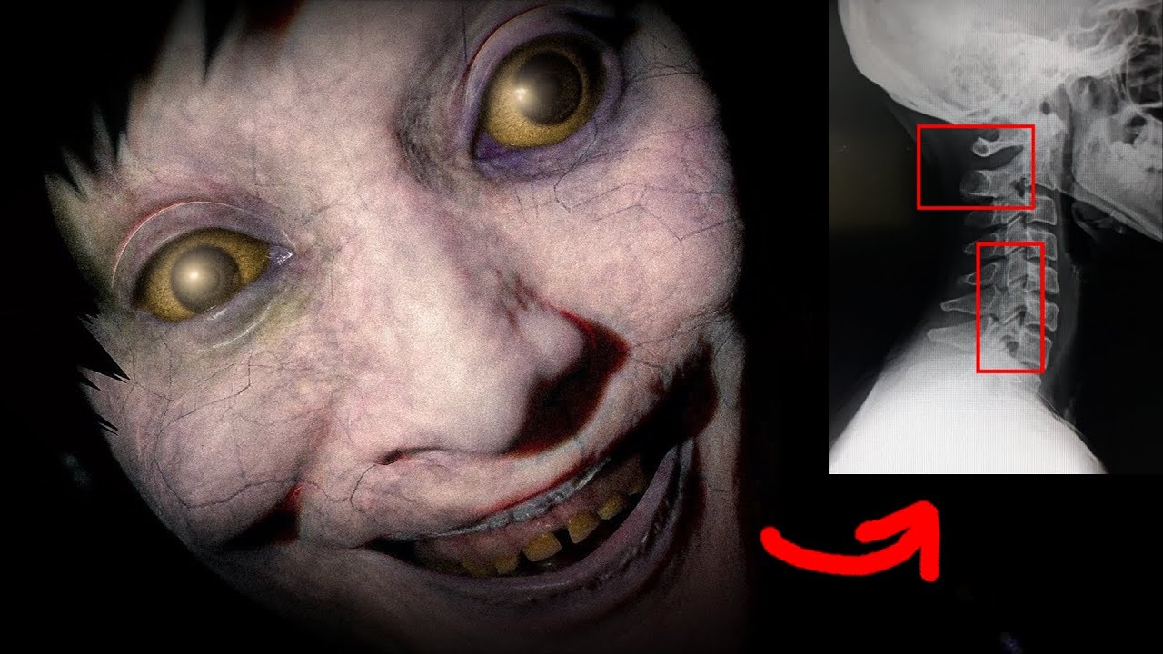 Este Juego me Provocó una Lesión Cervical... (no es broma)