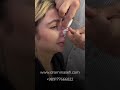 نتائج عملية تجميل الأنف | رعايات بعد جراحة تجميل الأنف | دکتور آصفي