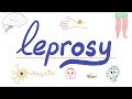 Leprosy (Hansen Disease) & Mycobacterium Overview