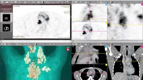 3D MPR axes synchronization