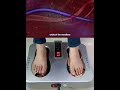 PEMF Physiotherapy Foot Massage Machine Acupuncture Ems Foot Massage Terahertz Foot Device