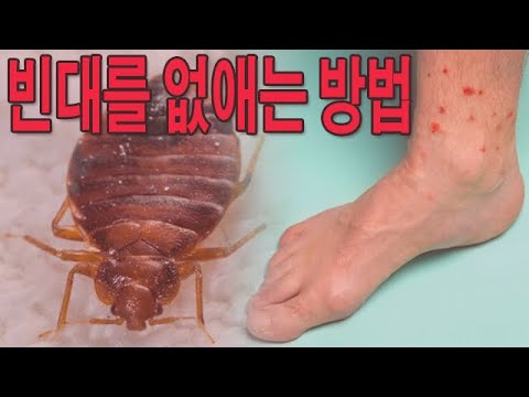 빈대를 없애는 방법