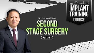 [ENG_SUB] Second Stage Surgery -  Introduction