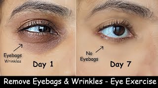 Lose Under Eye bags in 7 Days - Eye Exercises | Eye Wrinkles Puffy Eyes, DARK CIRCLES - Face Yoga