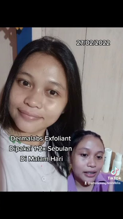 Rutin Basic Skincare Dari Nu Amoorea & Dermalabs Hasilnya Mantap