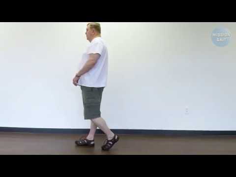 Hemiplegic Gait - Case Study 13