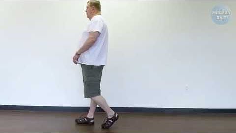 Hemiplegic Gait - Case Study 13