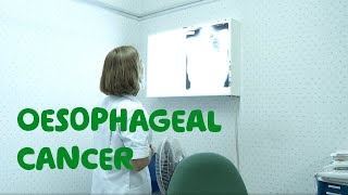 What Is Oesophageal (Gullet) Cancer? - Symptoms, Treatments & Diagnosis