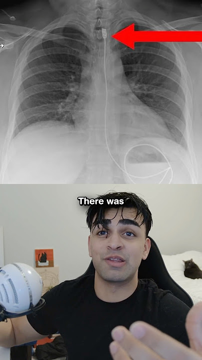Strangest Things Found Inside of Humans 🤔