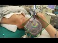 Medivis surgicalar augmented reality with tractography
