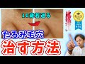 【プロが教える】老け顔の原因である頬の『たるみ毛穴』を撲滅する方法