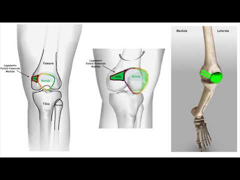 Video: Patella: Struttura, Funzione, Legamenti, Spostamento, Lussazione, Frattura