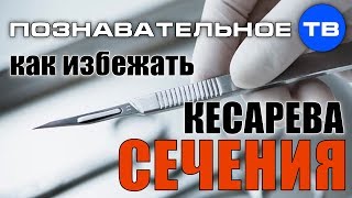 Как избежать кесарева сечения? (Познавательное ТВ, Ирина Волынец)