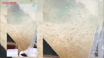 Cách Thả Tôm Giống Sống Nhiều | Dr.Tom Media