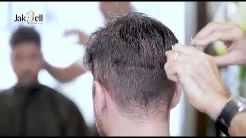 Como é colocado a prótese capilar?