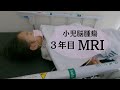 【小児脳腫瘍】3年目のMRI検査に行ってきました