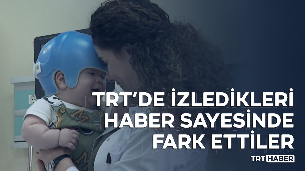 Bebeklerde kafatasında şekil bozukluğu