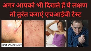 एचआईवी के शुरुआती लक्षण । HIV Ke Lakshan। HIV Symptoms Male & Female। AIDS lakshan । By Pathology।