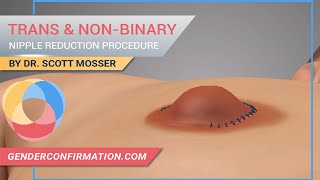 Transgender & Non-Binary Reduction Described By Dr. Scott Mosser