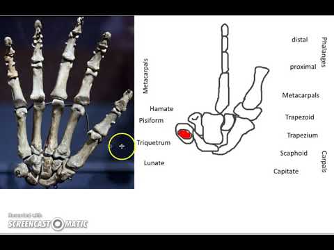 Speed learning the wrist bones, dr madden - YouTube