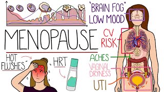 Menopause Explained Clearly (Includes HRT & Perimenopause) by Rhesus Medicine 16,738 views 6 months ago 9 minutes, 47 seconds