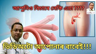How To Increase Male Sexual Power - 2 (In Assamese) | Food That Increase Male Sexual Power - 2