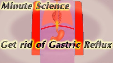 Eliminate gastric reflux (heartburn) instantly using this easy trick - Animated - No medication