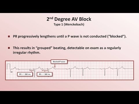 Intro to EKG Interpretation - AV Block