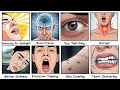Every Common NERVE MISFIRE Explained in 12 Minutes