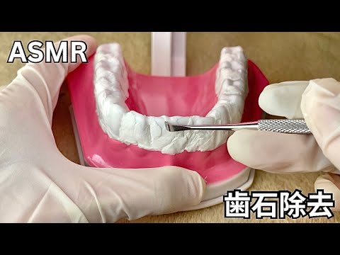 【ASMR】歯石取りの音（スケーラー・綿棒使用）｜Teeth Scaling Sounds | No Talking