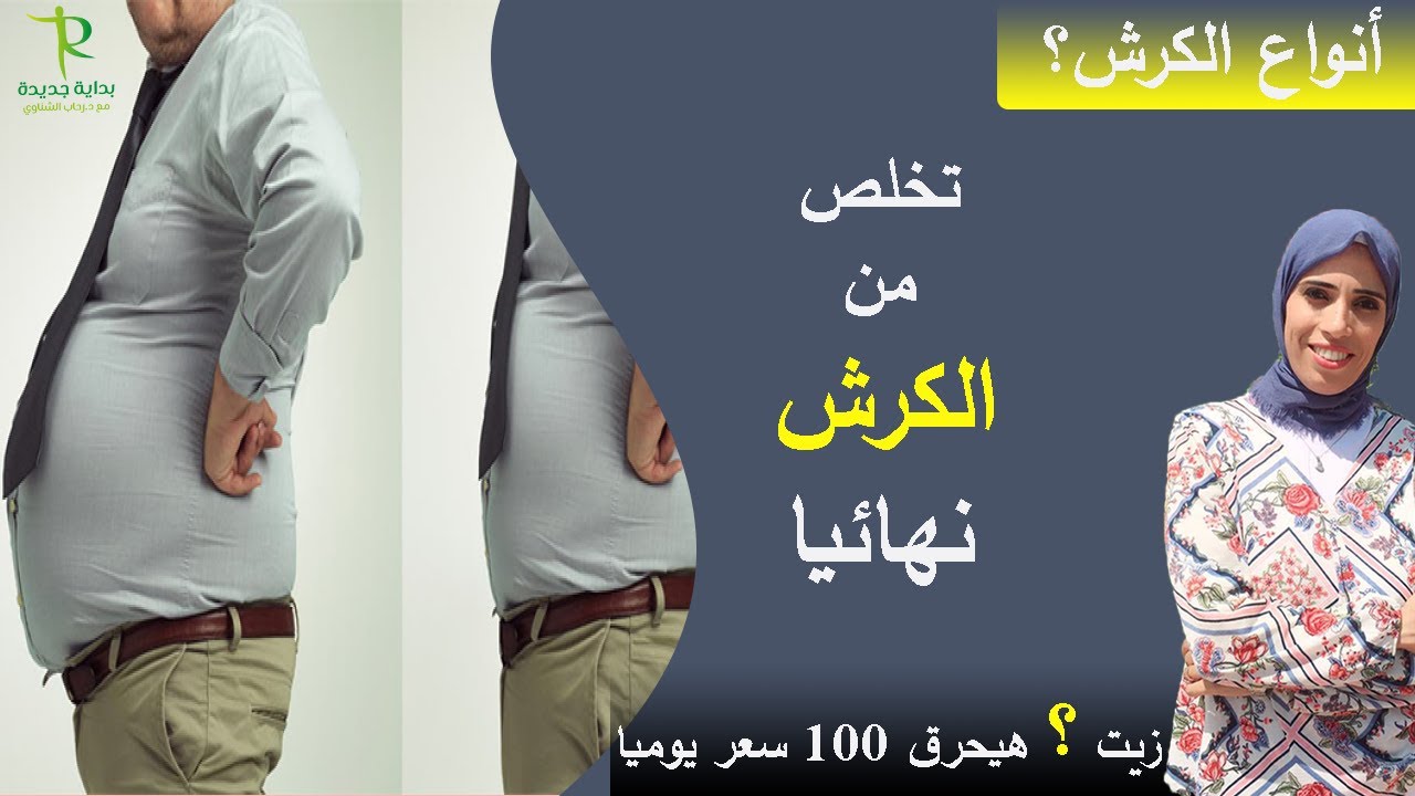 ١١٤- ياتري انت اي نوع من الكرش ! وازاي تتخلص من الكرش