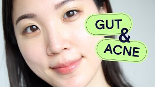 Why Gut Health is SO Important For Acne & How To Improve Gut Health For Glowing Skin | Acne School