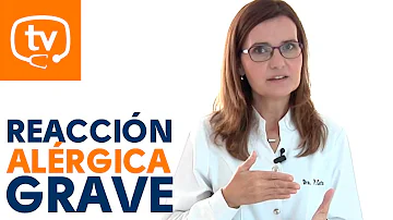 ¿Cómo saber si la reacción alérgica es grave?