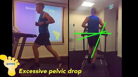 Enhance Running: excessive pelvic drop